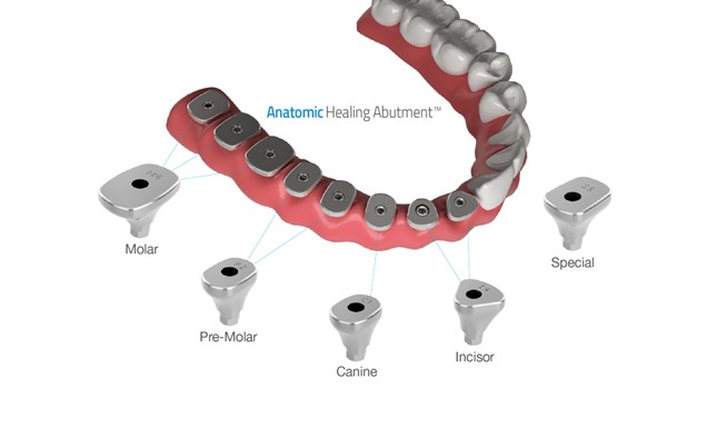 healing abutment